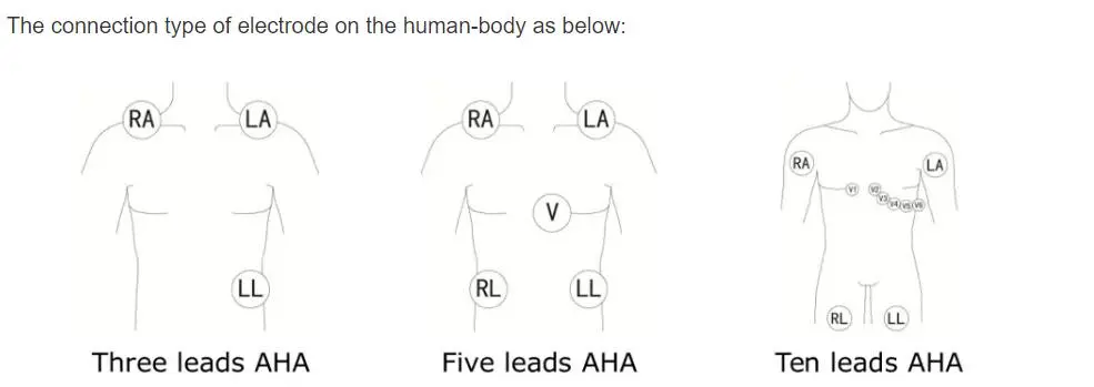 5-Kev Txhim Kho ECG leadwires rau philips digitrak ntxiv rau 24 teev ntaub qhwv 3100A, 5-txhuas, Snap